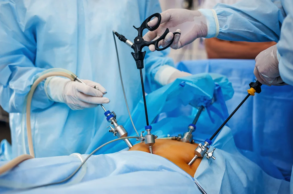 Laparoscopy Egypt
